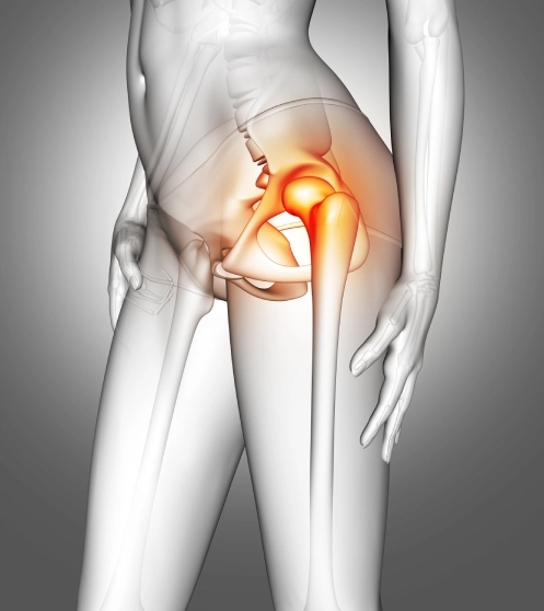 tratamiento-para-osteoporosis-en-queretaro.webp