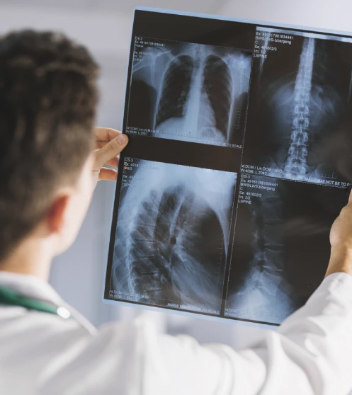 traumatologia-avanzada-en-queretaro.webp