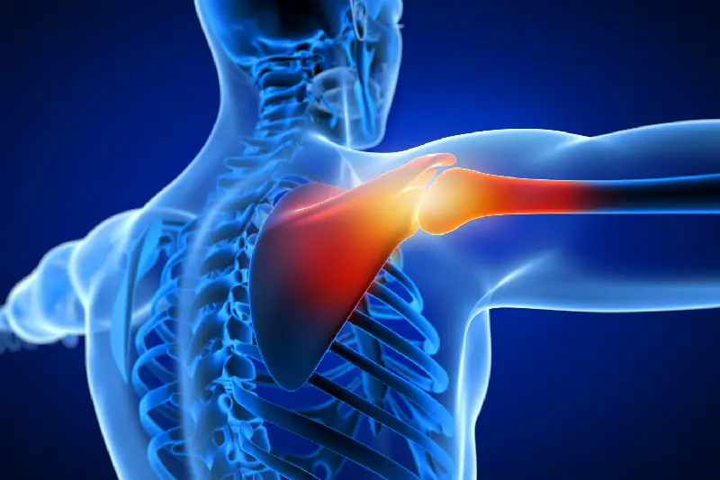 Cirugía de hombro, manguito rotador